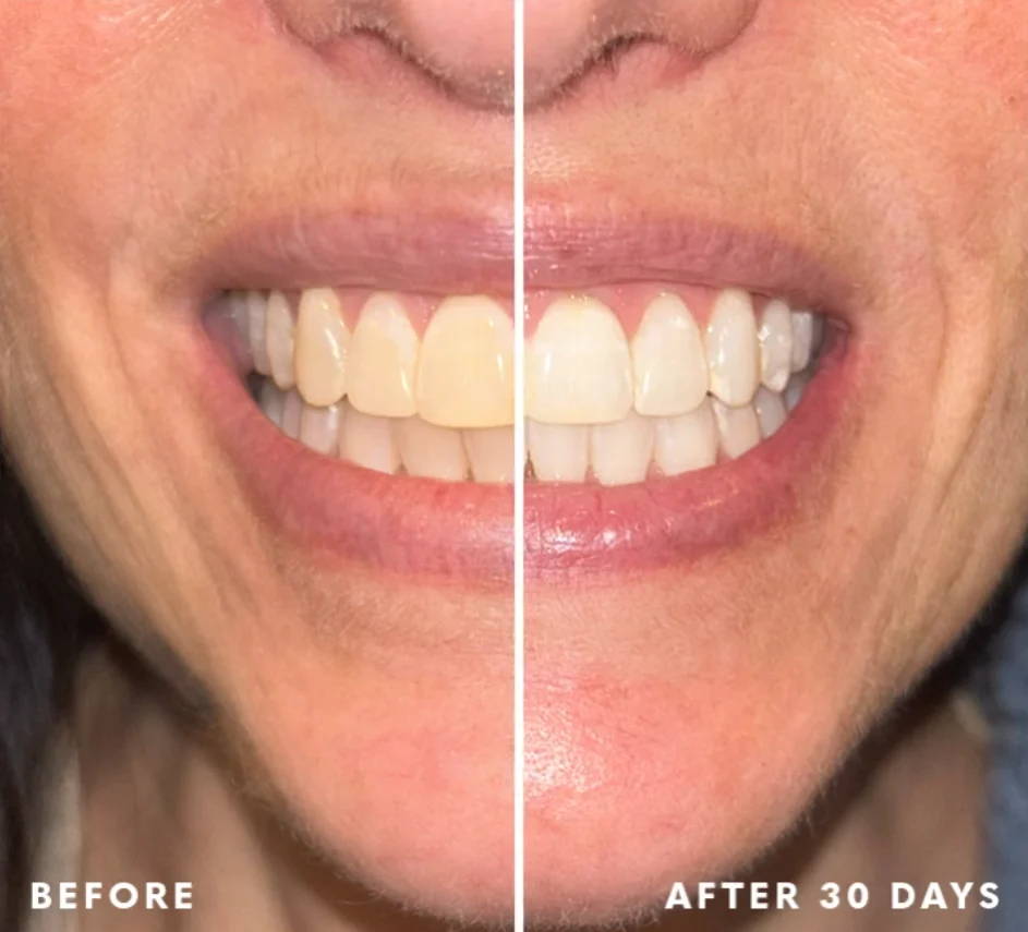 SEAGRIL® Bestsellers THE EASIEST WAY TO WHITEN YOUR TEETH - Image 3